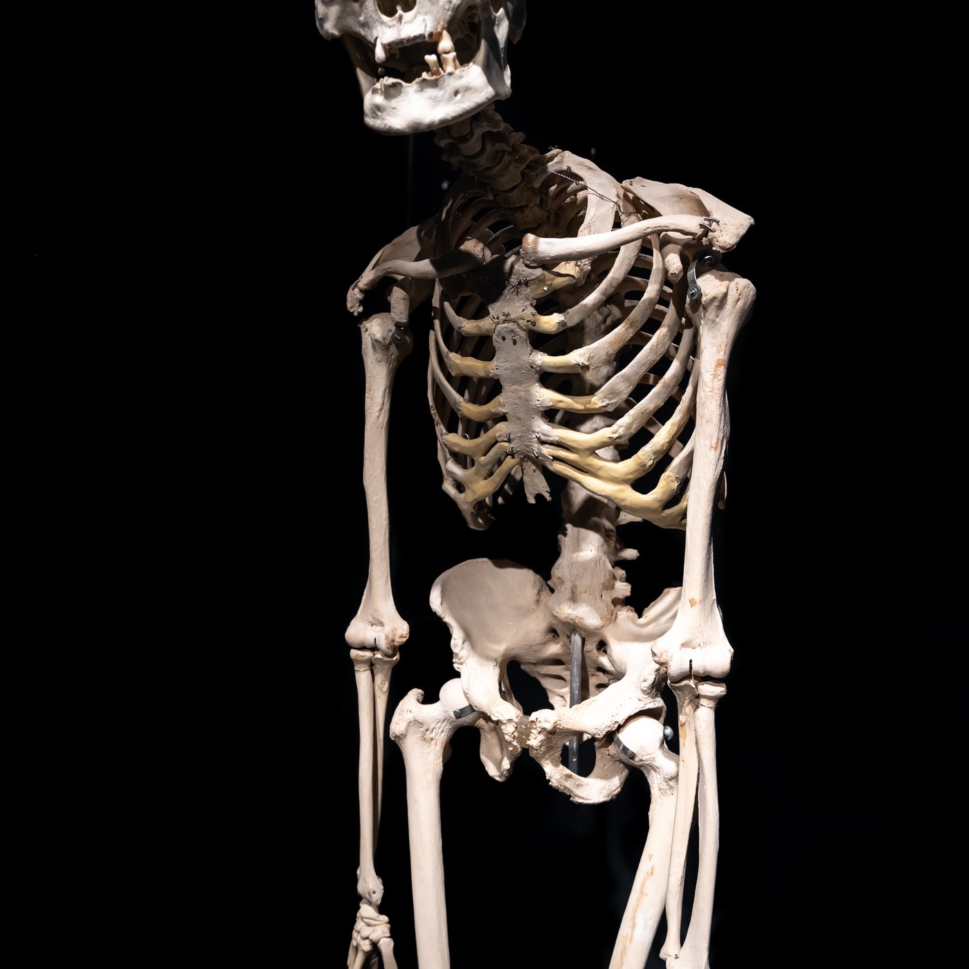 Your Skeleton Replaces Itself Every 10 Years: How Bone Remodelling ...