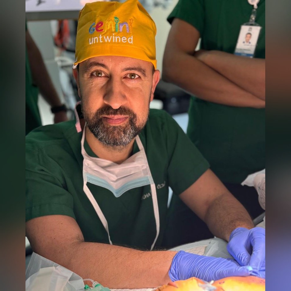Professor Owase Jeelani MBE paediatric neurosurgeon who separated conjoined twins
